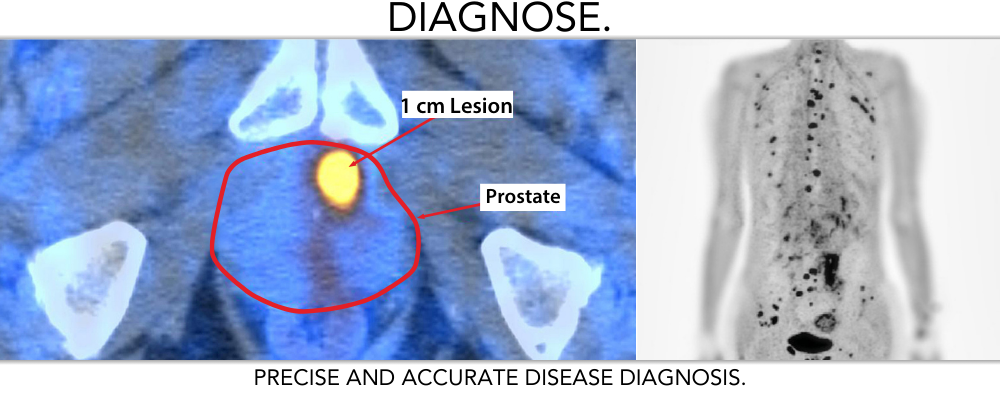 Precise and Accurate Disease Diagnosis. Precise and Accurate Disease Diagnosis.